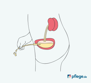 Kontinentes Urostoma Infografik