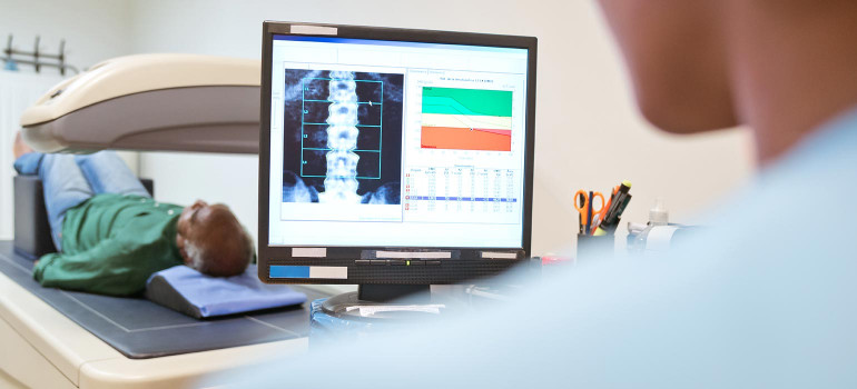 Osteoporose Prävention