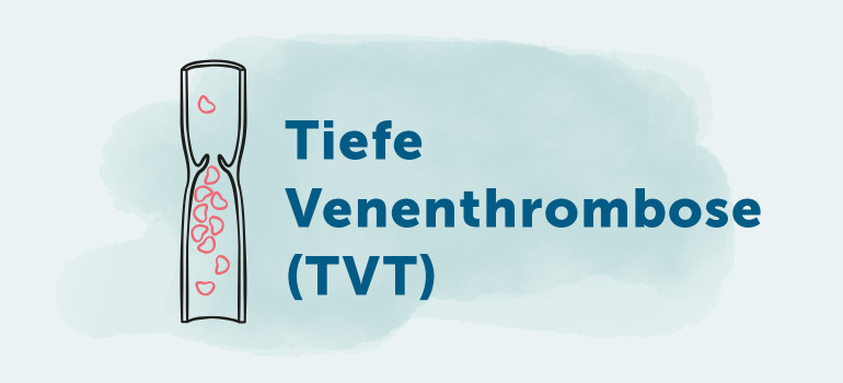 Tiefe Venenthrombose (TVT)