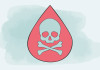 Sepsis