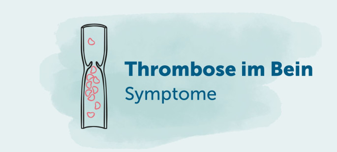 Thrombose im Bein Symptome und Bilder