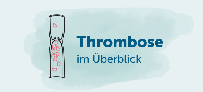 Thrombose im Überblick